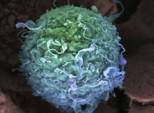 ابتكار جديد للعلماء يدمر الخلايا السرطانية في ثوان