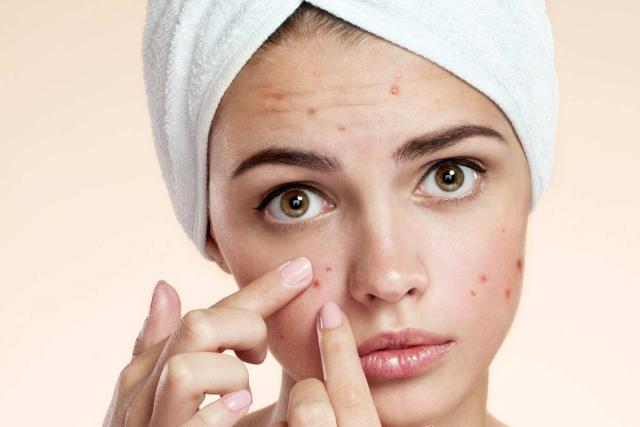  طرق طبيعية للتخلص من ندبات الوجه