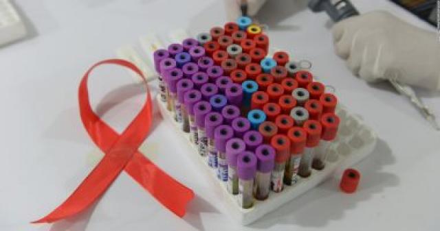 تعافى ثالث حالة فى العالم من الإيدز بعد زرع خلايا جذعية من دم الحبل السرى