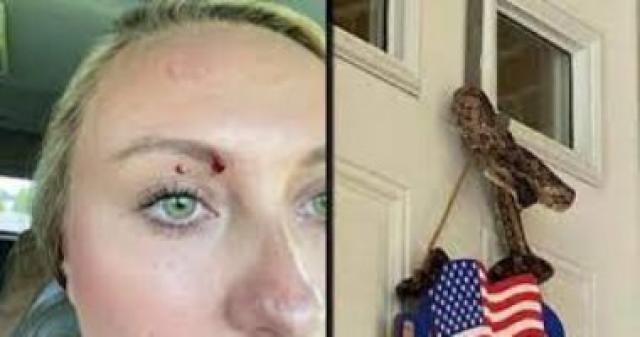 أمريكية تُفاجأ بثعبان على باب منزلها يلدغها بالقرب من عينيها.. صور