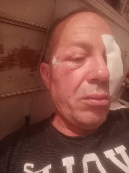 إصابة قائد قطار اكسبريس شربين/ طنطا  بسبب قذف القطار بالحجارة