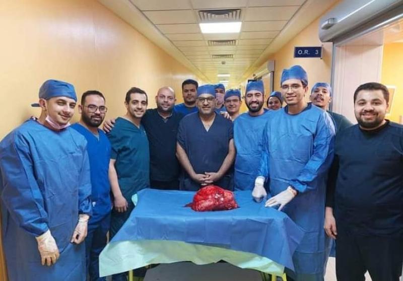 جامعة أسيوط تعلن عن نجاح فريق طبي في استئصال ورم خبيث يزن 20 كجم بالكلية اليمنى لمريض