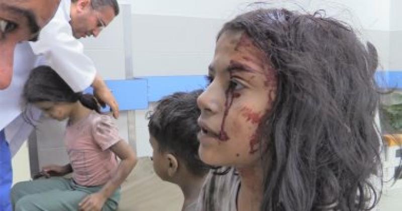 إصابة طفلة فلسطينية في العدوان على غزة