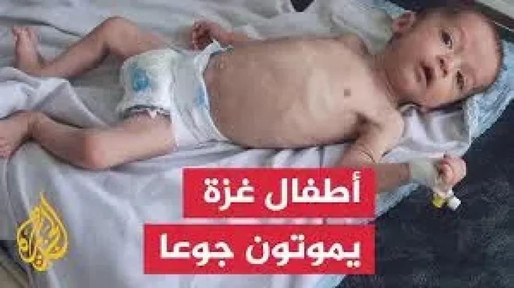 ماتت من الجوع.. وفاة طفلة من غزة بسبب المجاعة والعدد يرتفع لـ54 طفلا