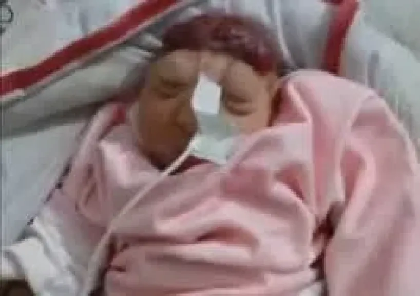 ولادة طفلة في غزة بلا دماغ.. أسلحة إسرائيل تشوّه الأجنّة في الأرحام