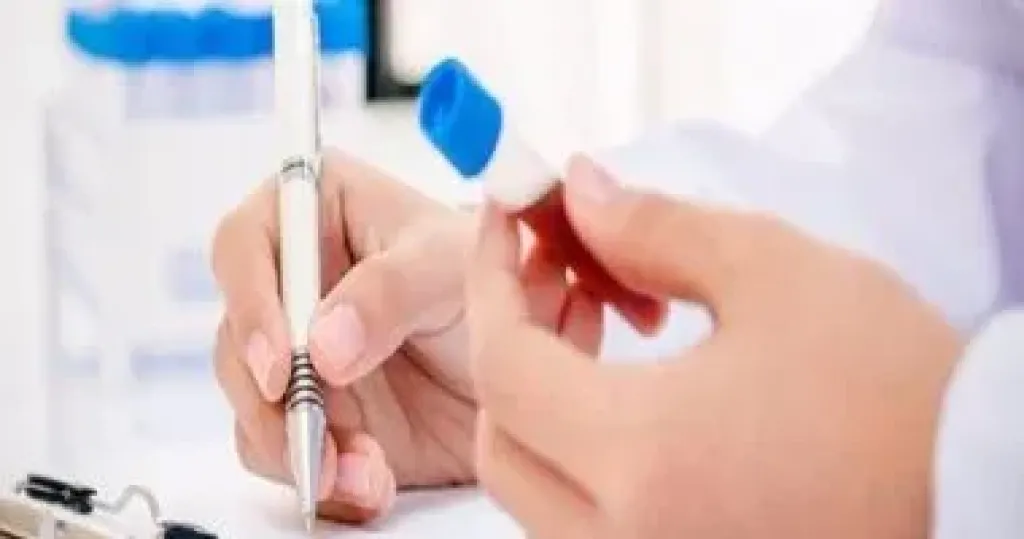 هل يساعد فحص الدم في اكتشاف حب الشباب.. اعرف التفاصيل