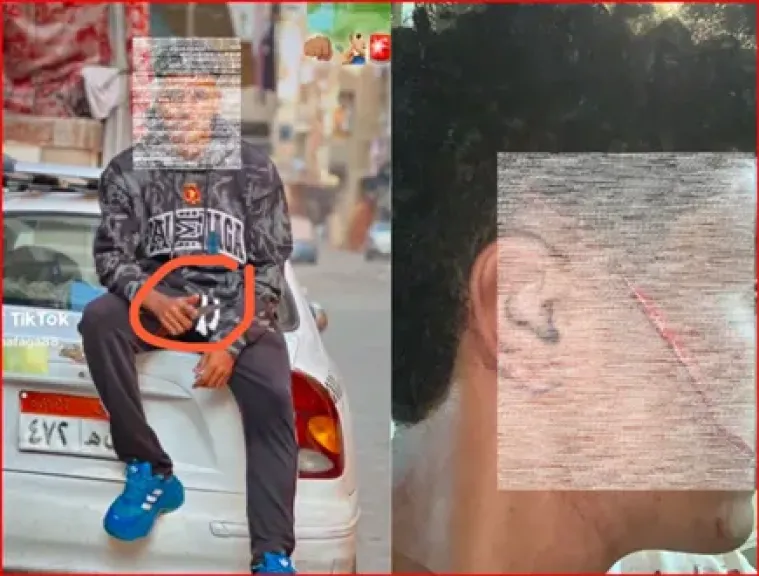 مأساة «عمار» مستمرة.. شاب شوه وجهه بـ89 غرزة في روض الفرج ويهدده للتنازل عن القضية | صور