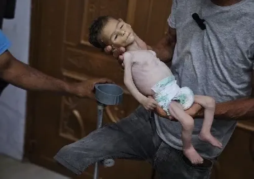 تفطر القلوب غزة.. أطفال لا يستطيعون البكاء من شدة الجوع ويموتون بين يدي ذويهم وعالم يراقب بفزع وجزع
