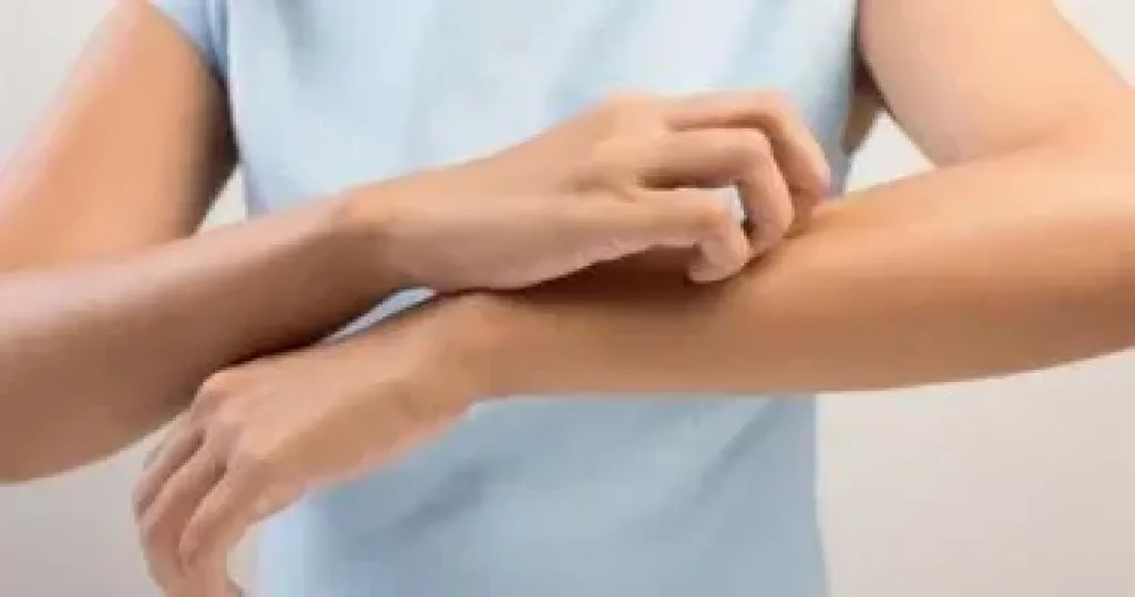أفضل نظام غذائى لتجنب الإصابة بالحساسية