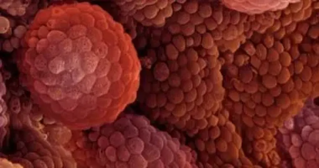 أطعمة يجب تناولها وتجنبها للتعافى بشكل أفضل أثناء علاج السرطان