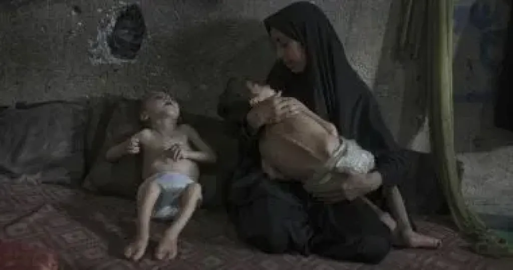 تحذيرات طبية من مجاعة تهدد حياة آلاف الفلسطينيين