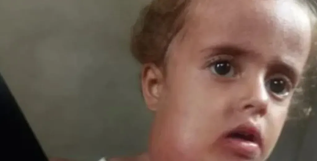 ورم في رقبتها وصعوبة بالنطق.. عجز المنظومة الصحية بغزة يهدد حياة الطفلة جوليا