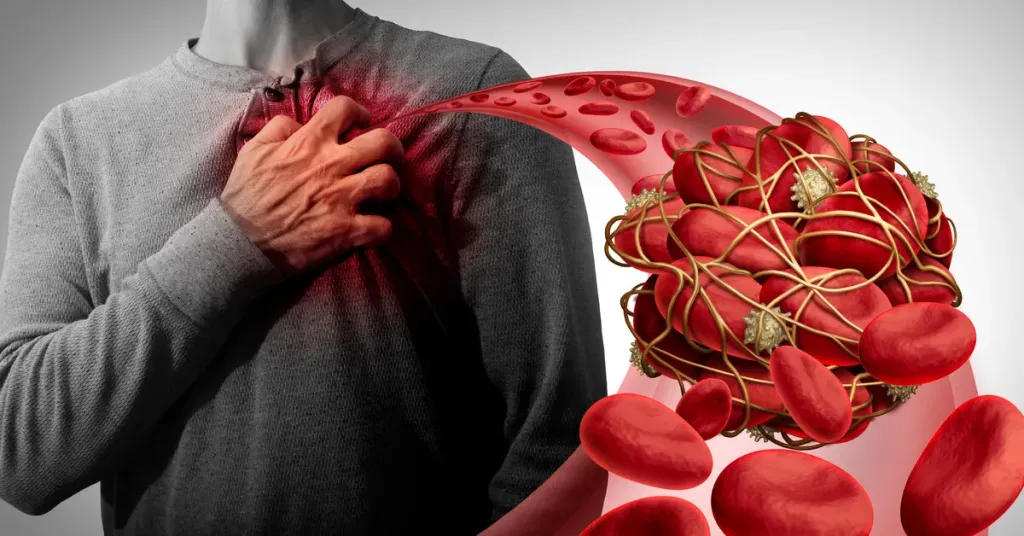 مشروبات تنظف شرايين القلب وتحميه من الجلطات