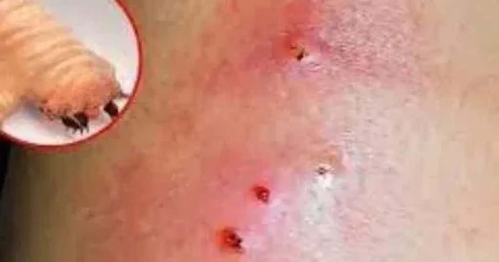 بعد اكتشاف أول حالة بأمريكا.. ما هي الدودة الحلزونية ” آكله اللحوم الحية”