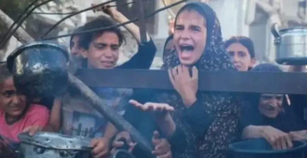 وفاة 7 فلسطينيين نتيجة التجويع وسوء التغذية في غزة