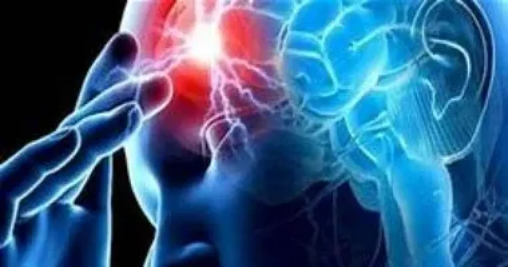 تحفيز الدماغ.. تقنية جديدة لعلاج الصرع غير المستجيب للأدوية