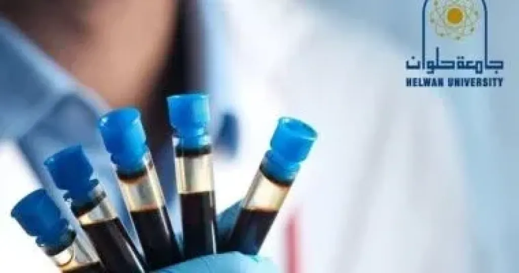 اطلاق حملة للتبرع بالدم بجامعة حلوان بالتعاون مع الهلال الأحمر المصرى اطلاق حملة للتبرع بالدم بجامعة حلوان بالتعاون مع الهلال الأحمر المصرى