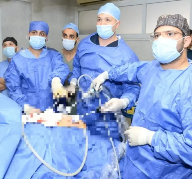 مستشفيات جامعه اسيوط تنظم ورشة عمل حول استخدام الحلقة السيليكون