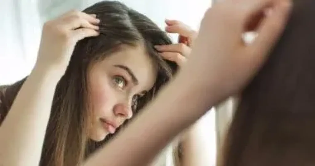 علاجات منزلية لتهدئة حكة فروة الرأس المصابة بالصدفية