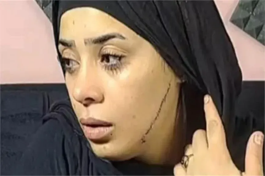 تأجيل محاكمة المتهمة بتشويه وجه عروس مصر القديمة بـ41 غرزة