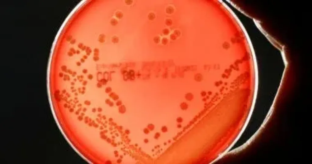 اكتشاف بكتيريا قادرة على التظاهر بالموت حتى فى بيئة معقمة