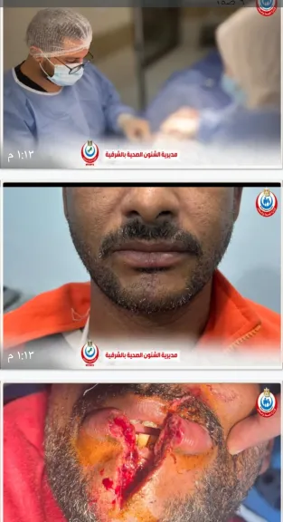 صحة الشرقية: إجراء جراحة متقدمة   بمستشفى ههيا المركزي