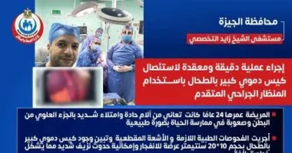 فريق جراحى بمستشفى الشيخ زايد التخصصى ينجح فى استئصال كيس دموى بالطحال