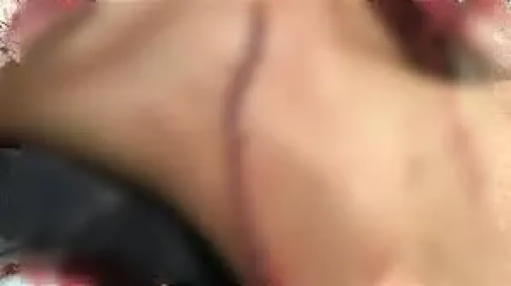 أصابوه بجروح مميتة، أطباء مستشفى العجمي ينقذون طالبا بالإعدادية اعتدى عليه مجهولون بالطريق