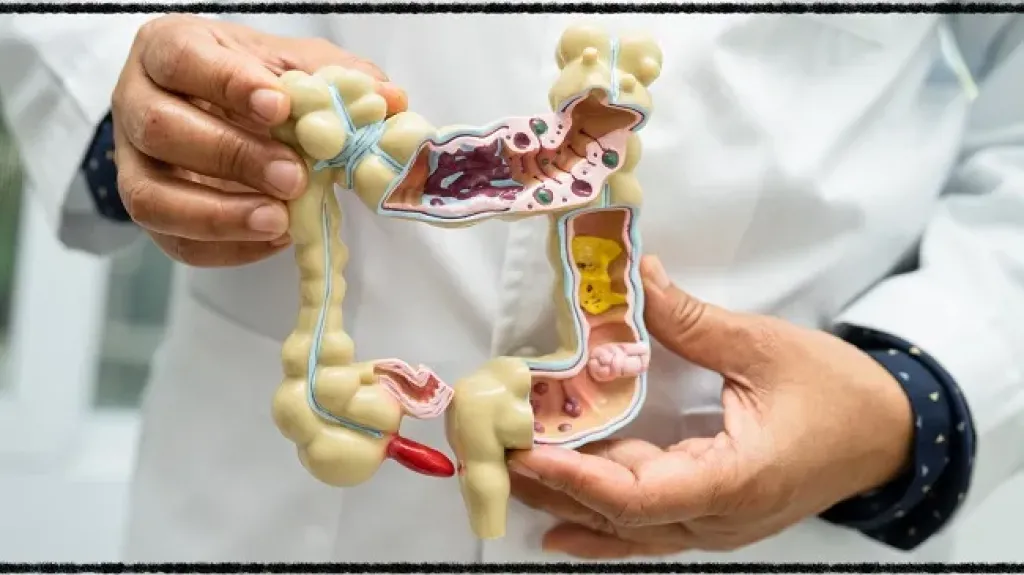 اكتشاف جديد قد يساعد في محاربة سرطانات الأمعاء والكبد