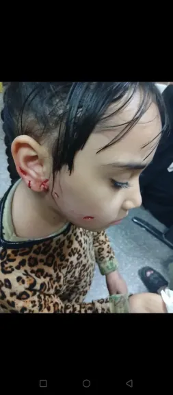 ضحايا كلاب الشوارع .. عرض مستمر !!