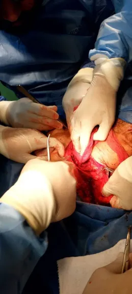 إنقاذ حياة مريض