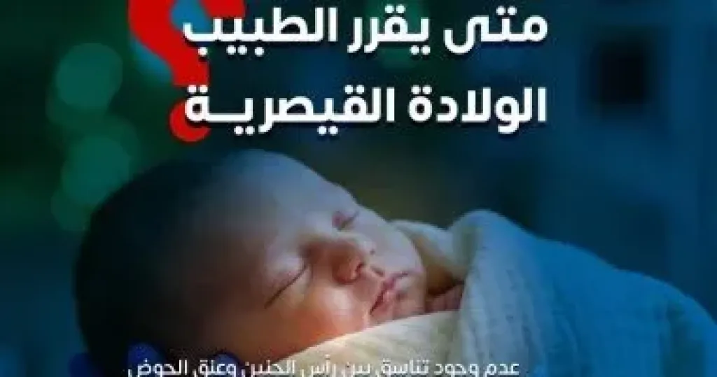 متى يقرر الطبيب اللجوء للولادة القيصرية؟.. وزارة الصحة توضح