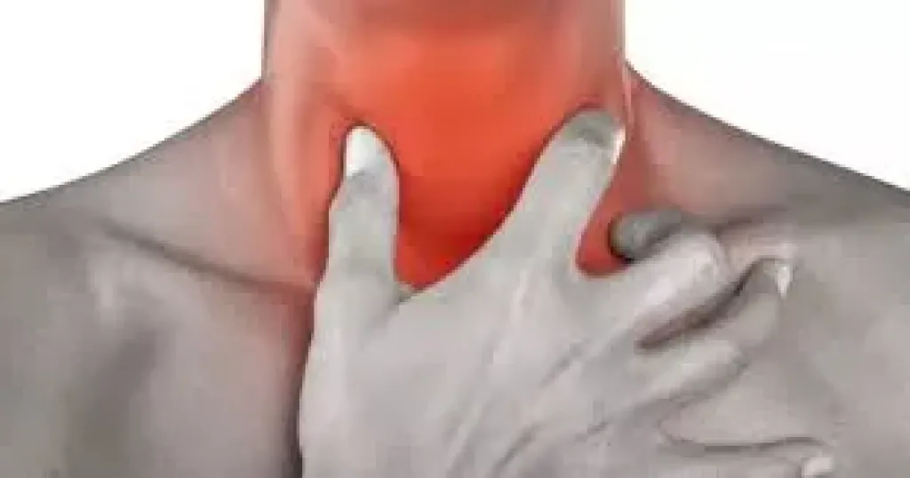 التهاب الحلق فى الصيف.. لماذا يحدث رغم ارتفاع درجات الحرارة؟