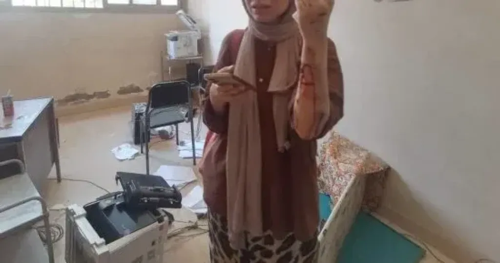 كسر بالذراع وجروح.. تفاصيل حالة طبيبة أسنان شبرا الخيمة بعد الاعتداء عليها