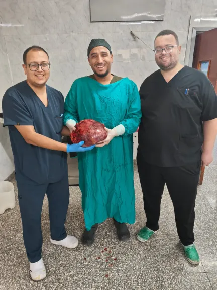 فريق طبي مشترك بقسمي الجراحة العامة والنسا  بجامعة أسيوط ينجح في استئصال ورم مبيضي ضخم