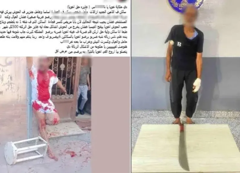 «ركنة موتوسيكل» تتحول لكارثة.. جار يقطع أوتار يد شاب في بورسعيد