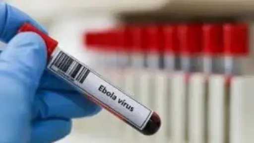إصابة عاملة إغاثة أمريكية بسلالة بونديبوجيو من إيبولا في الكونغو