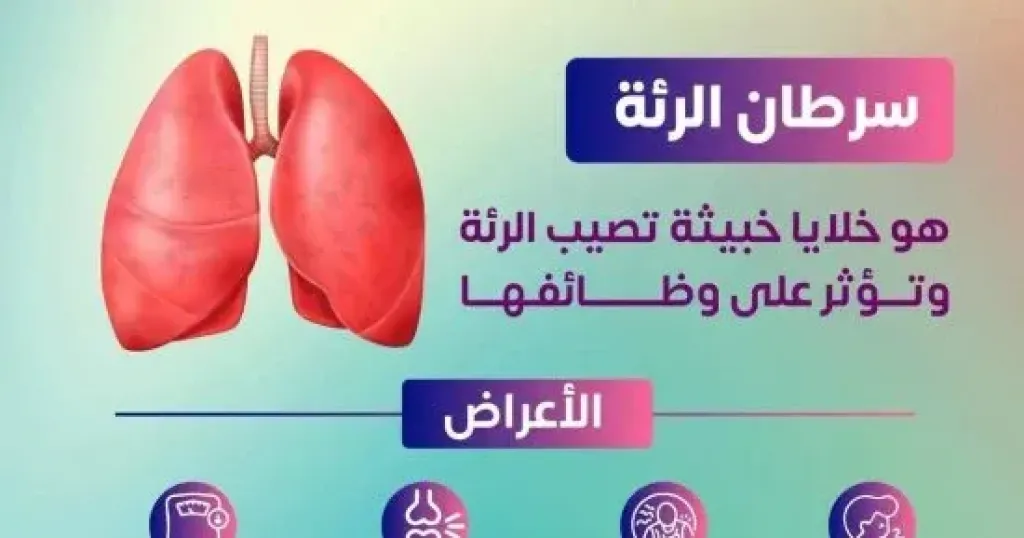 قد تكشف سرطان الرئة.. «الصحة» تحذر من تجاهل 4 علامات.. تعرف عليها